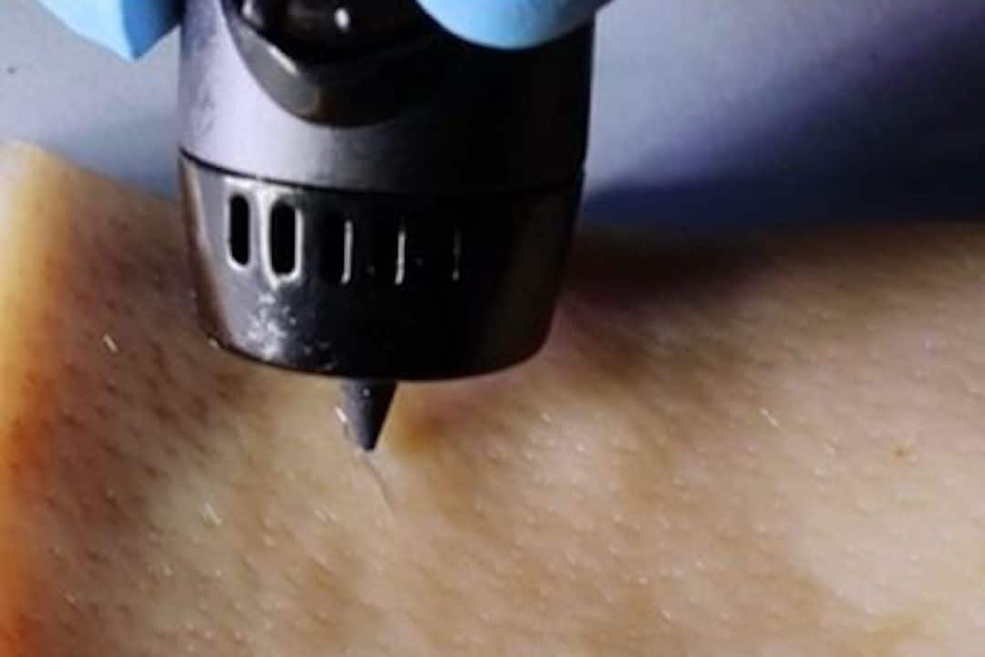 3d-pen-healing-gel