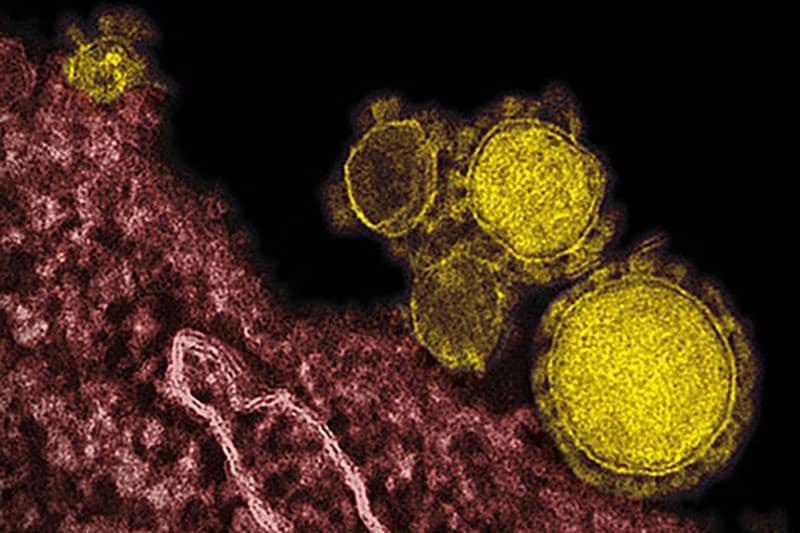 new-case-of-mers-virus-uae