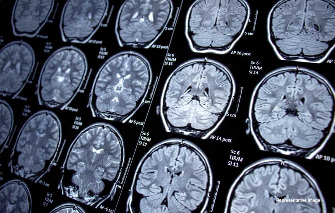Brain-imaging study curiosity develops in the brain