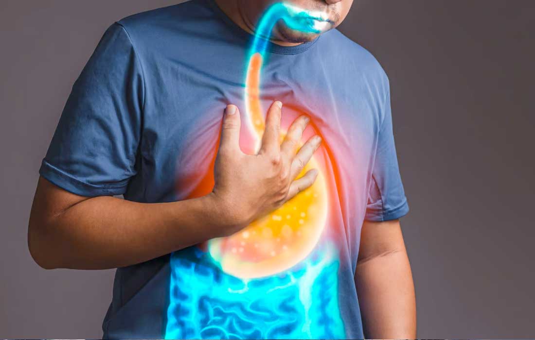 Heartburns affecting your lifestyle? What foods can prevent acidity?