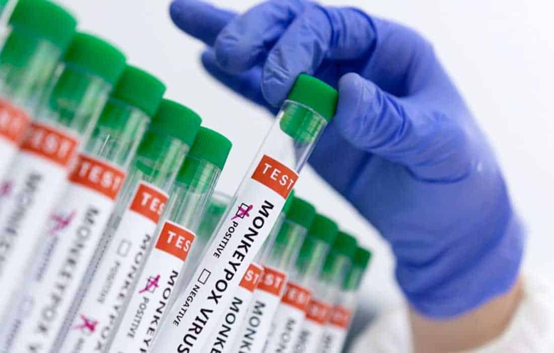 Italy, Korea raise mpox alert level