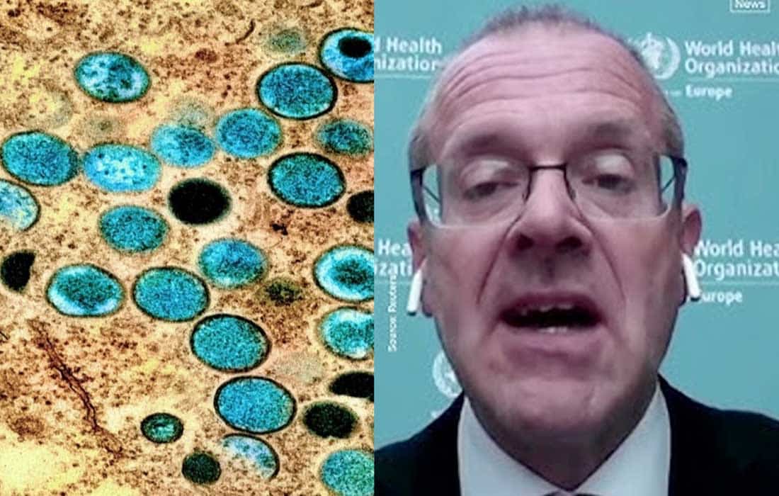 Mpox is not the new COVID, says WHO official