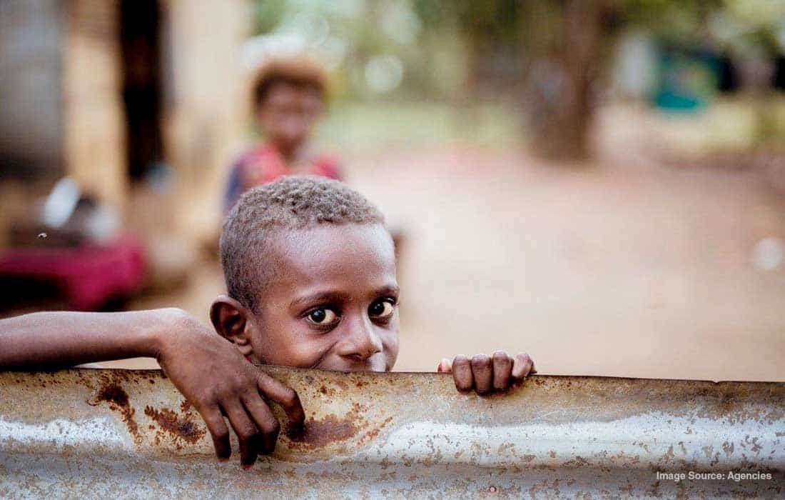 Over 77 million children, adolescents in MENA suffer from malnutrition UNICEF