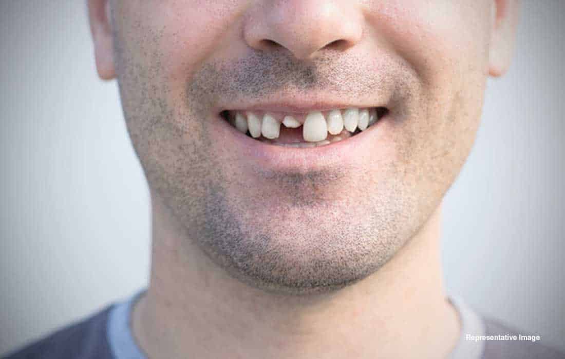 Human trials begin for drug that lets adults regrow teeth like kids