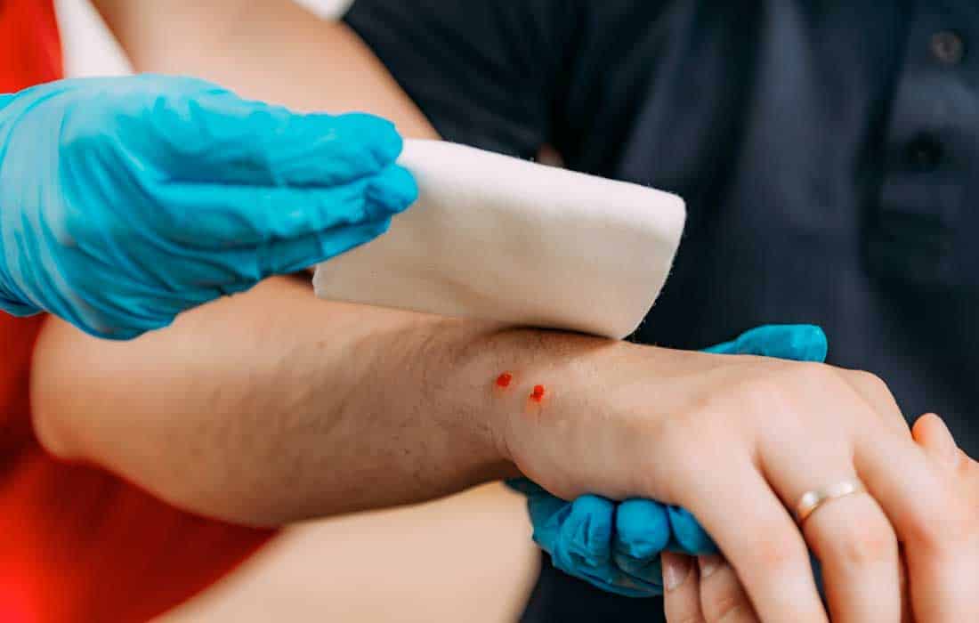 One person dies from snake bite every 4-6 minutes worldwide: WHO