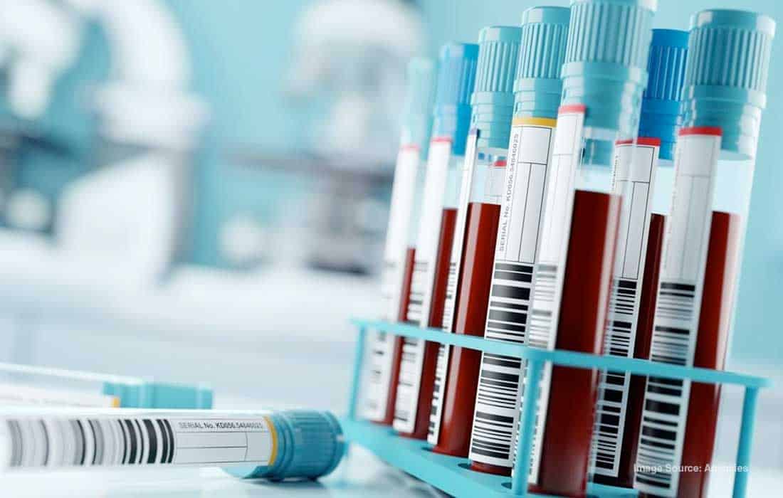 Abu Dhabi launches advanced liquid biopsy for colorectal cancer
