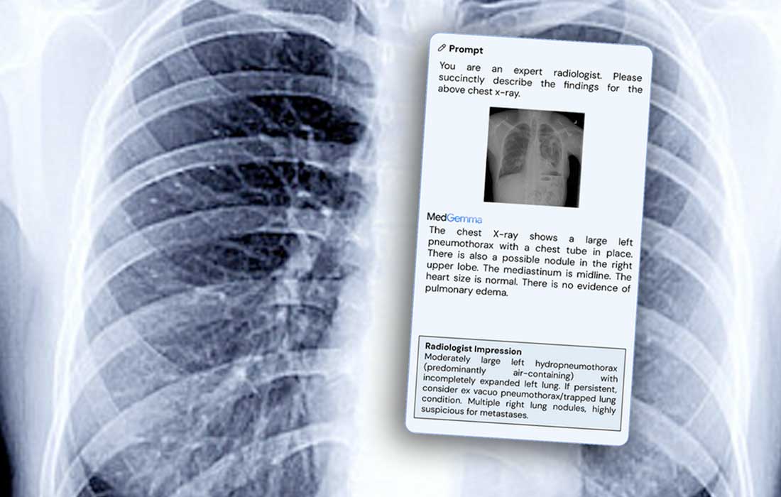 Google just dropped MedGemma AI that reads X-rays better than doctors