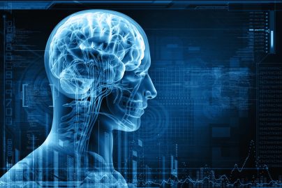 The Silent Killer in Our Heads: Why Brain Aneurysms Deserve Urgent Attention