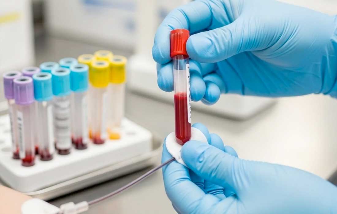 India discovers rare CRIB blood group in a woman