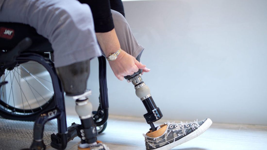 UAE prosthetic program transforms lives with free osseointegration surgeries for patients from Palestine, US, and India under 10 Journeys Initiative.